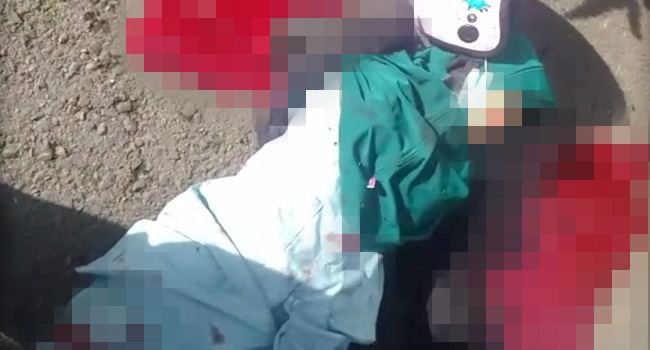 Wanita Kecelakaan Tunggal hingga Putus Tangan di Abdya Menghembuskan Nafas Terakhir di RSUZA